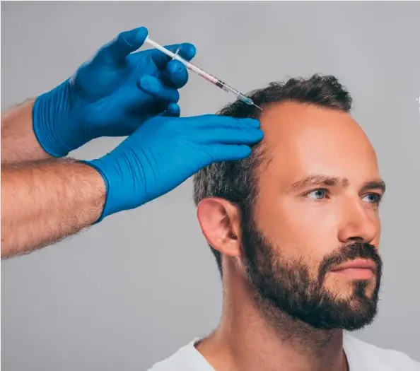 Mesoterapia capilar avanzada: Innovación biotecnológica para la regeneración del cabello